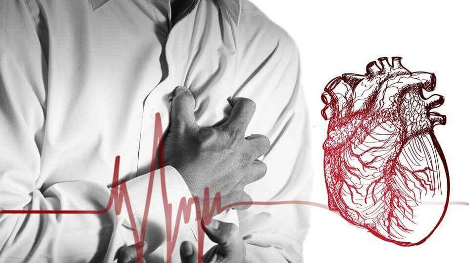 Aufgrund des gestörten Herzrhythmus bei thorakaler Osteochondrose kann es zu einer Extrasystole kommen