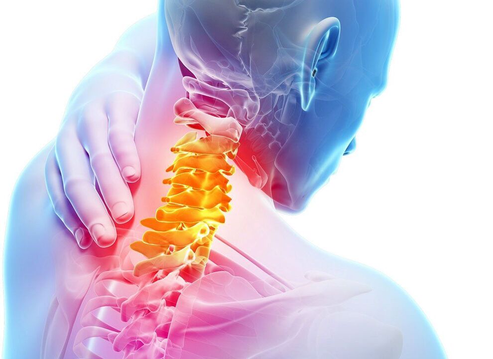Symptome einer spinalen Osteochondrose