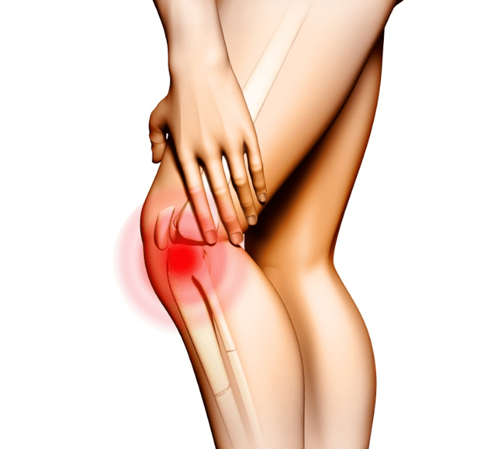 Osteoarthritis -Phase