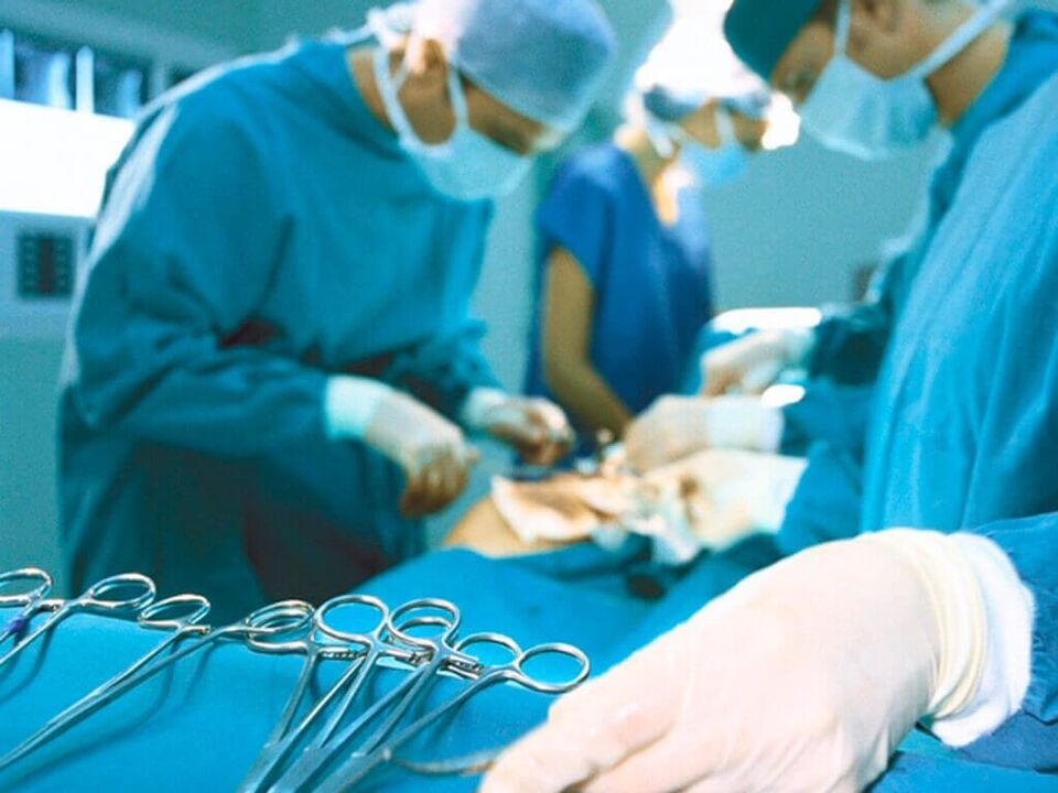 Operation