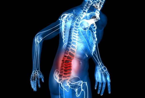 Symptome der Osteochondrose