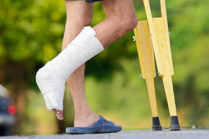 Knöchelverletzungen als Ursache für Arthrose