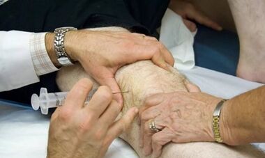 Wie man Arthritis von Arthrose unterscheidet